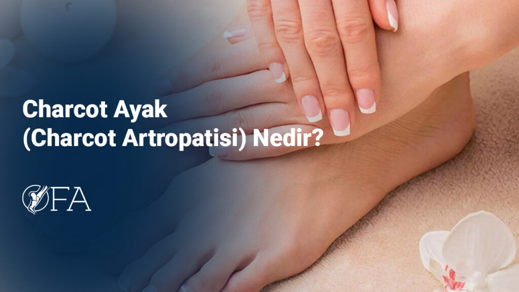 Charcot Ayak (Charcot Artropatisi) Nedir?