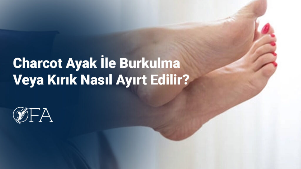 Charcot Ayak İle Burkulma Veya Kırık Nasıl Ayırt Edilir?