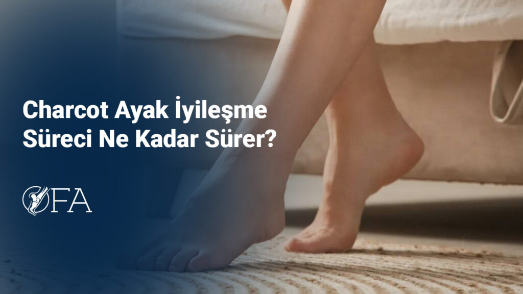 Charcot Ayak İyileşme Süreci Ne Kadar Sürer?