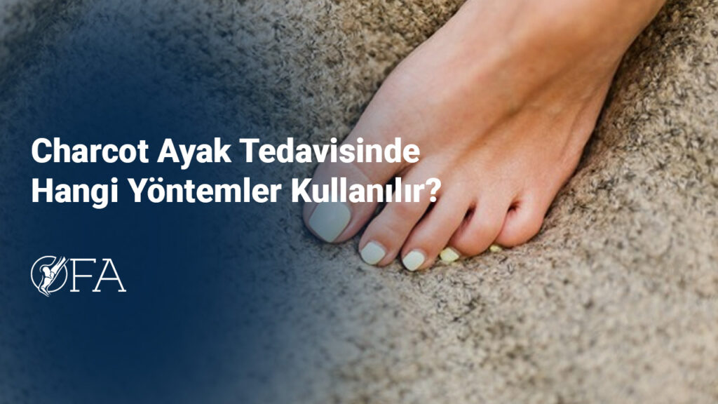 Charcot Ayak Tedavisinde Hangi Yöntemler Kullanılır?
