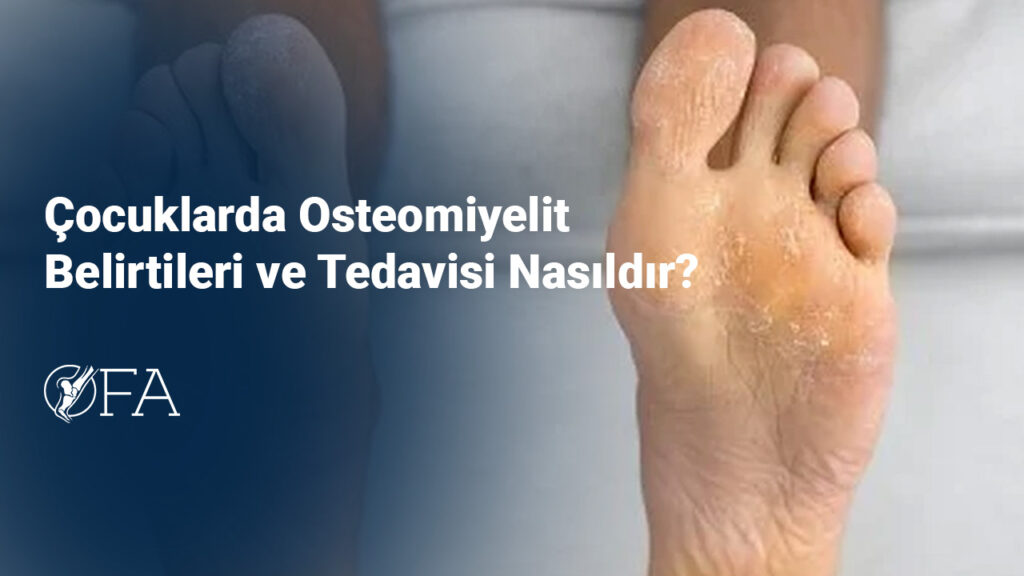 Çocuklarda Osteomiyelit Belirtileri ve Tedavisi Nasıldır?