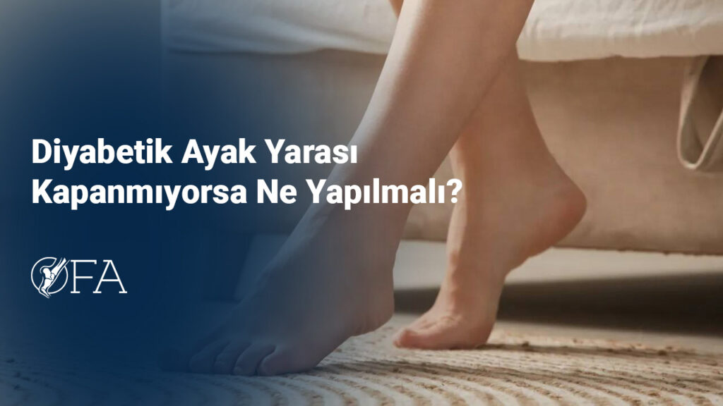 Diyabetik Ayak Yarası Kapanmıyorsa Ne Yapılmalı?