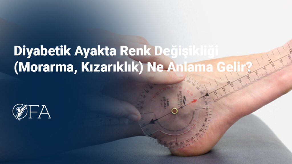 Diyabetik Ayakta Renk Değişikliği (Morarma, Kızarıklık) Ne Anlama Gelir?