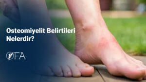 Osteomiyelit Belirtileri Nelerdir
