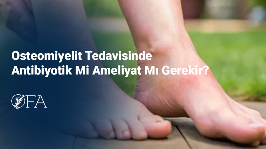 Osteomiyelit Tedavisinde Antibiyotik Mi Ameliyat Mı Gerekir?